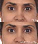 Ματιών Μάσκες Αντιγήρανσης Murad Retinol Youth Renewal Eye Masks